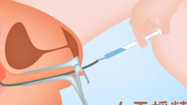 人工授精具有一定优势