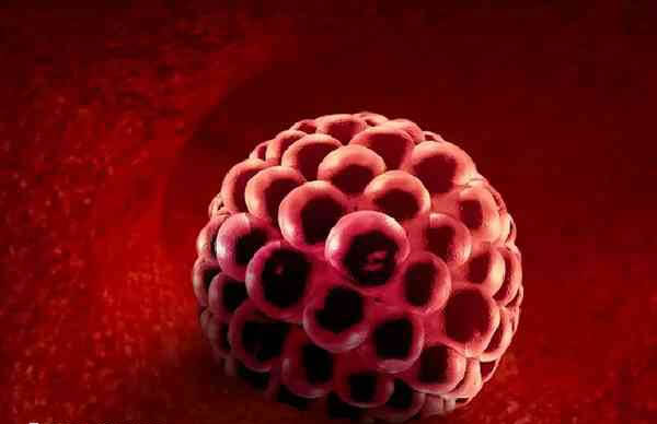 医生建议单囊胚移植