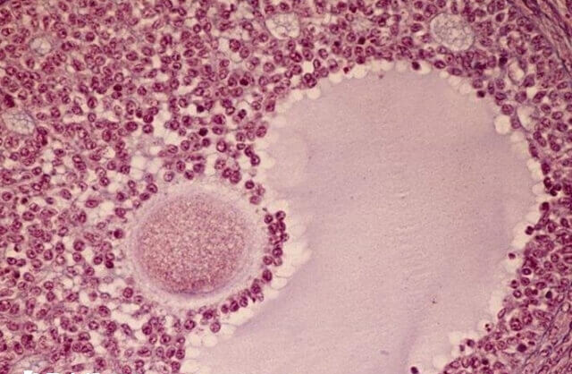 年龄低于35的女性促排效果较好