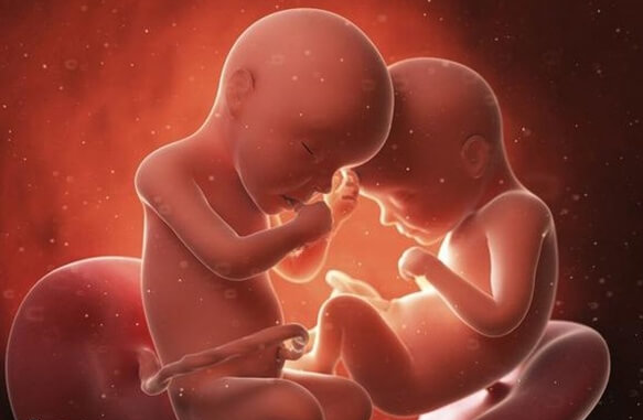 怀双胞胎死亡率高