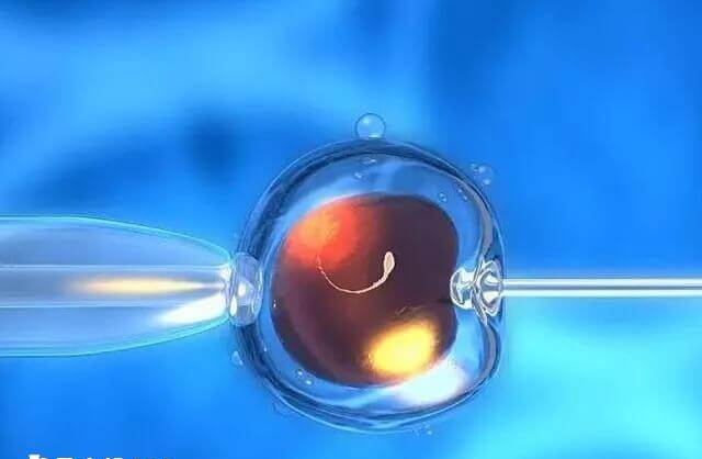 试管婴儿是在体外受精