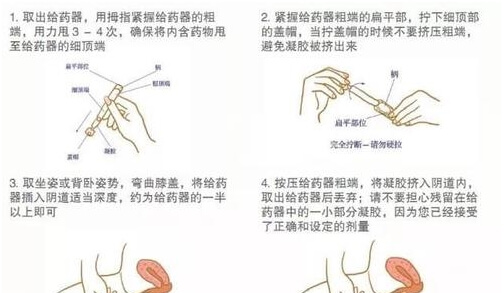 雪诺酮的使用方法