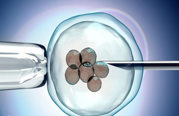 试管婴儿是体外受精