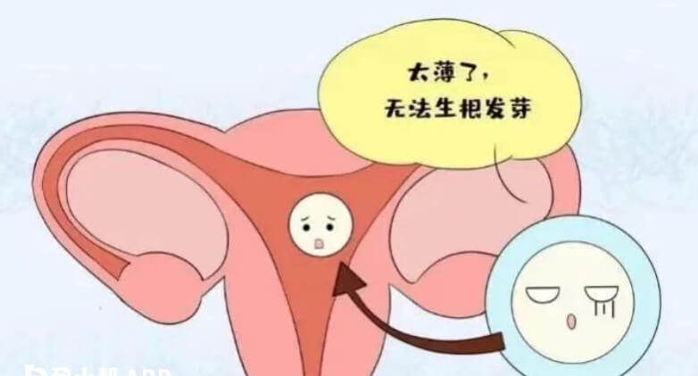 宫腔灌注能提高子宫内膜容受性