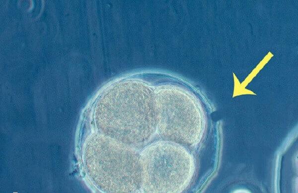 胚胎辅助孵化可以提高着床率