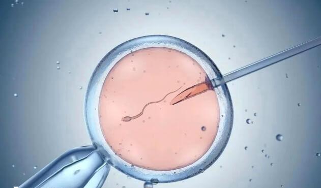 短时授精是针对短时ivf受精失败的补救措施