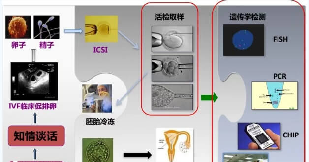 第三代试管婴儿的流程