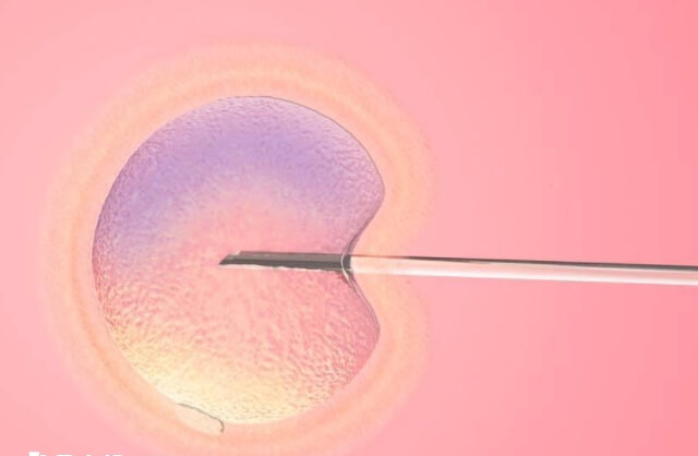 第三代试管婴儿比二代还晚出现