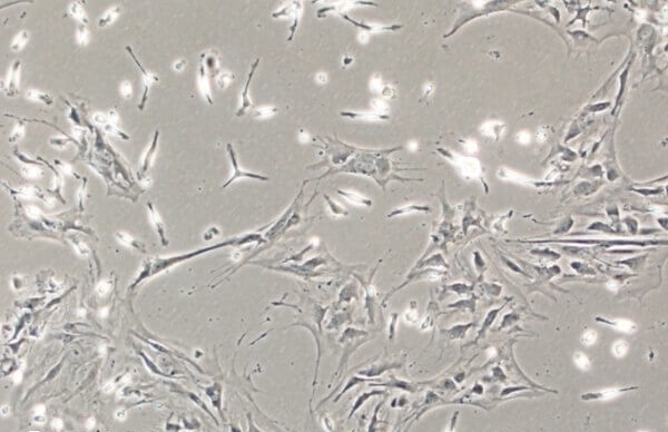 目前女女不能通过骨髓技术生孩子