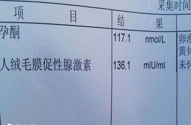 胚胎着床失败后HCG水平无变化