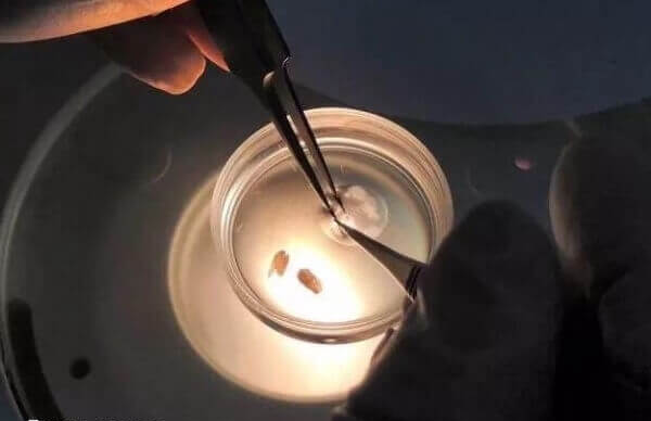 鲜胚移植成功有腰酸感