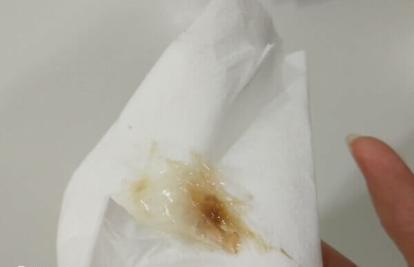 着床失败的分泌物