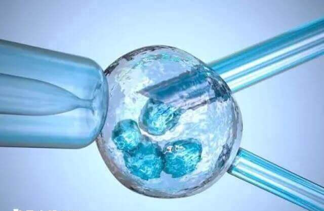 取卵后女性体内可能会出现腹水