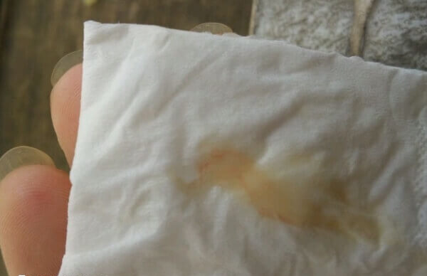 着床成功的分泌物