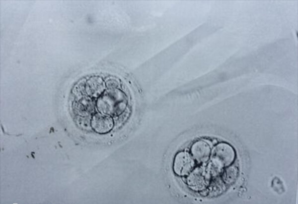 4bc囊胚不属于优质胚胎