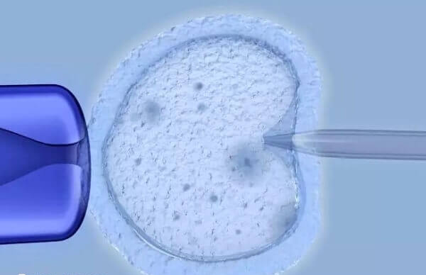 超长方案的优点是成功率高