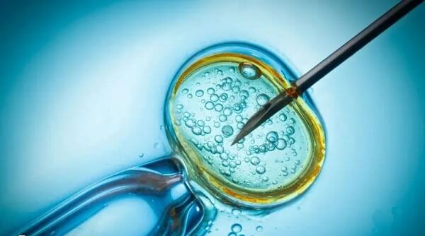 卵胞浆内单精子显微注射