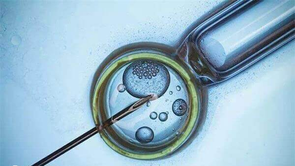 抗结剂方案流程