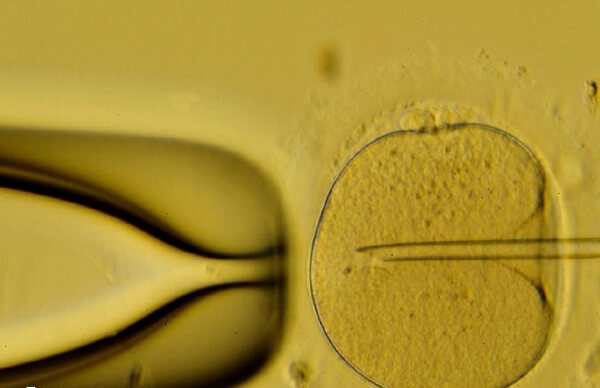 取卵手术费用2000-9000元左右