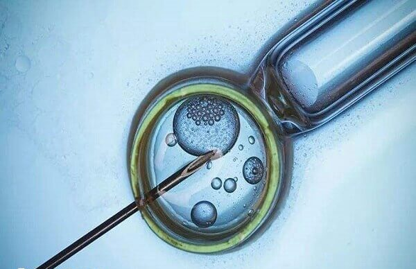 拮抗剂方案不能说明卵泡质量好不好