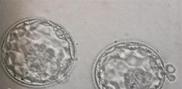 养囊6天与5天的囊胚发育程度不同