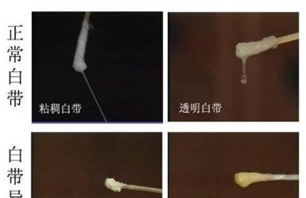 着床成功正常白带图片
