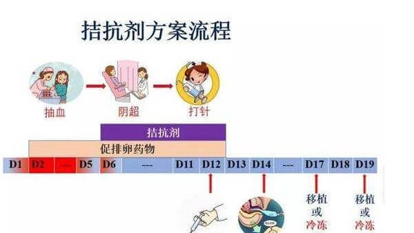 拮抗剂方案整体流程