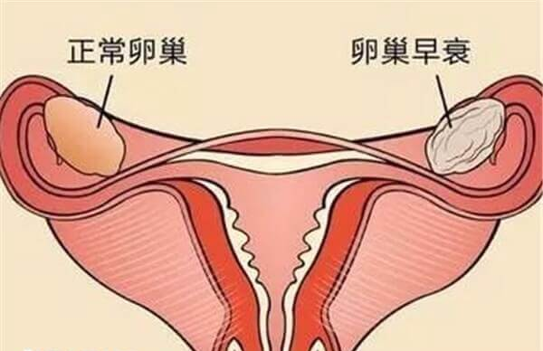 冷冻卵巢组织费用五万元以内