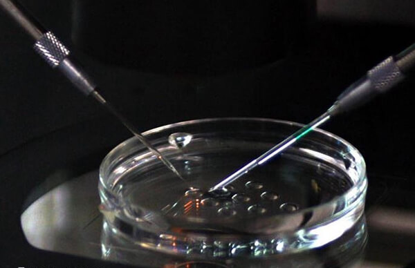 山大生殖取卵手术费用在一万左右