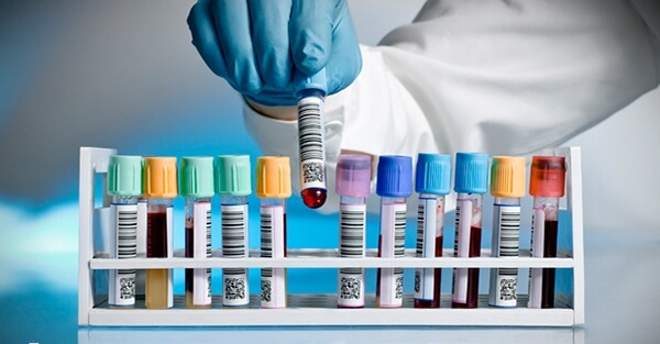 促排FSH高LH低是卵泡差的表现