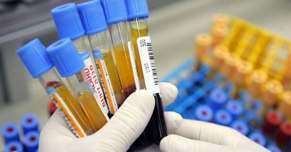 鲜胚移植后养囊全失败需明确原因