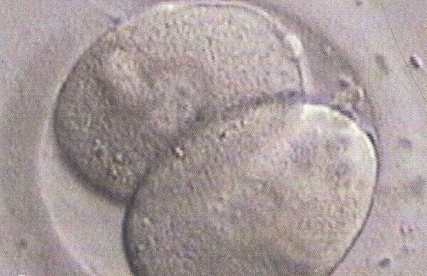 鲜胚移植不适合所有人