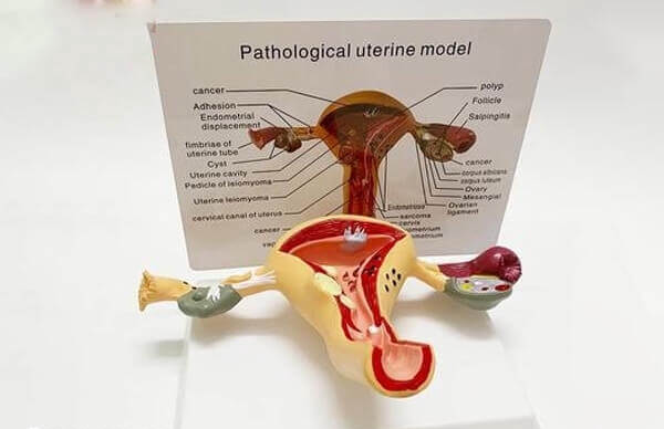 始基子宫是先天性发育不良
