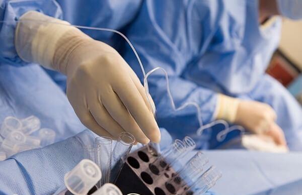 取卵后可能会有腹部不适