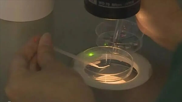 做试管婴儿需要取卵和取精