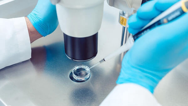 取卵是在b超引导下进行的