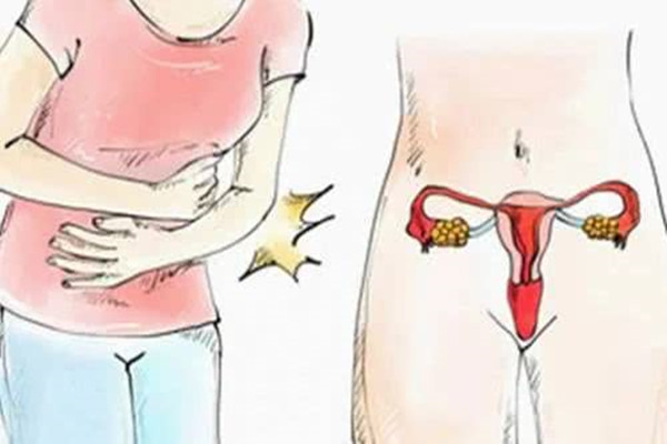 宫颈糜烂会导致不孕吗?