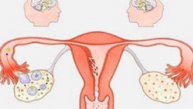 宫腔粘连的检查方法有哪些？