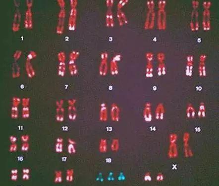 唐氏筛查-染色体结构示意