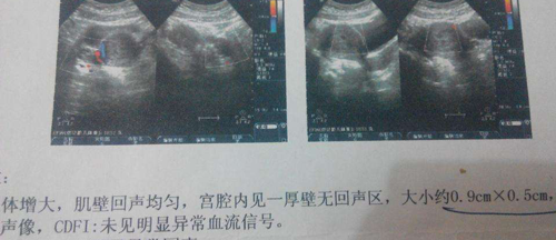 怀双胞胎两个月肚子图