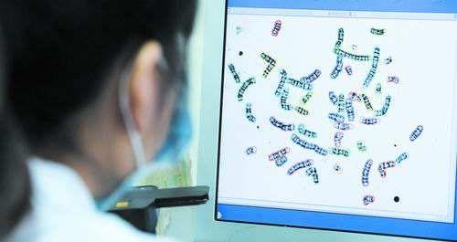 染色体检查报告单图