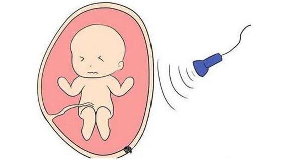 胎儿的发育要用多种手段进行检测