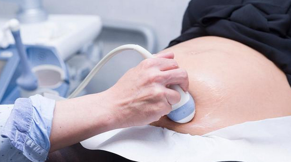超声检查不影响胎儿