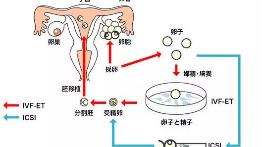 试管婴儿流程