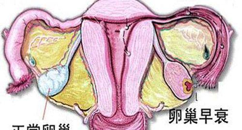 卵巢早衰的表现有哪些