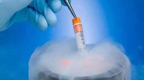 多数试管婴儿周期会安排胚胎冷冻