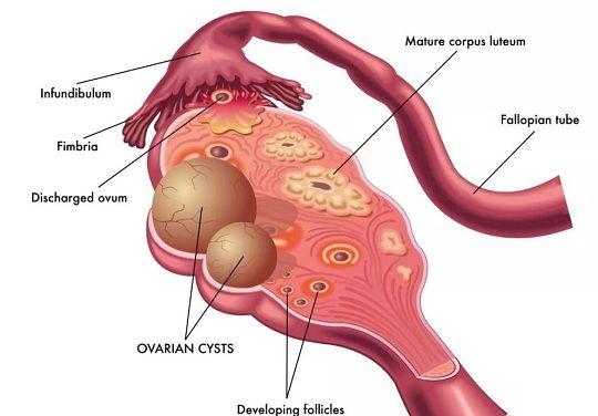 卵巢结构图