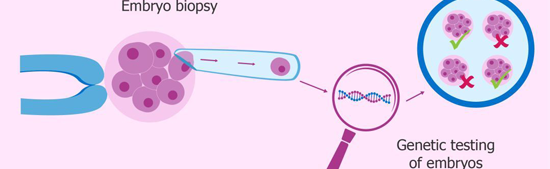 第三代试管婴儿技术PGD