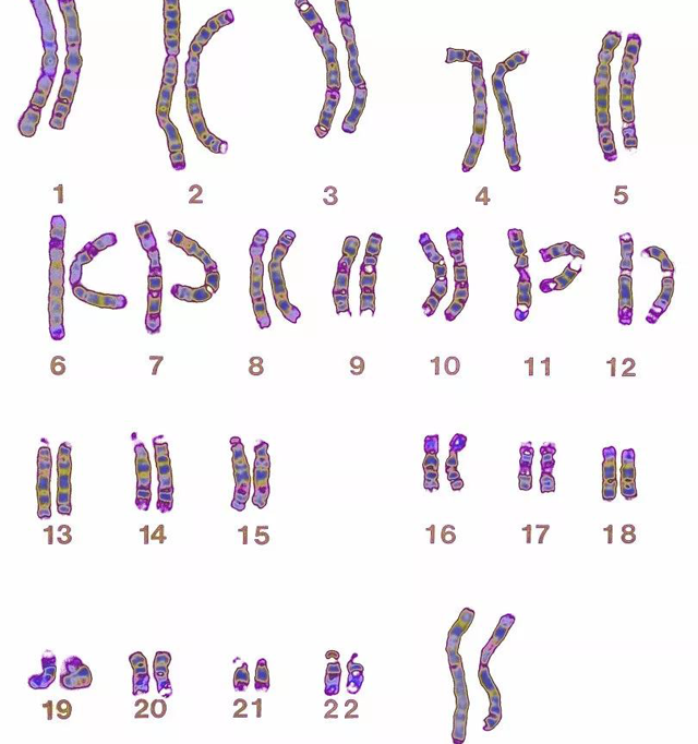 23对染色体
