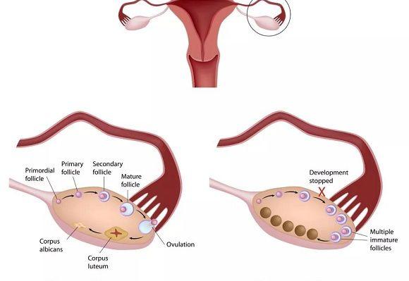 宫腔结构图